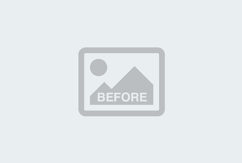 Before Image: Bella Body Lift - front